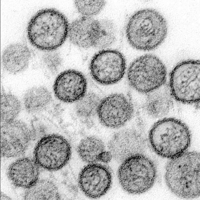 TRES MUERTOS EN UN CRUCERO QUE ZARPÓ DE USHUAIA EN UN PRESUNTO BROTE DE HANTAVIRUS